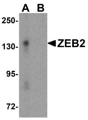 Western Blot: ZEB2 AntibodyBSA Free [NBP1-77179]