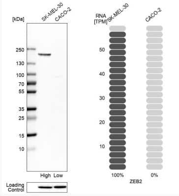 Western Blot: ZEB2 Antibody [NBP1-82991]