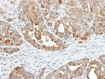 Immunohistochemistry-Paraffin: ZER1 Antibody [NBP1-32801]