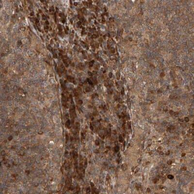 Immunohistochemistry-Paraffin: ZFAND1 Antibody [NBP1-82242]