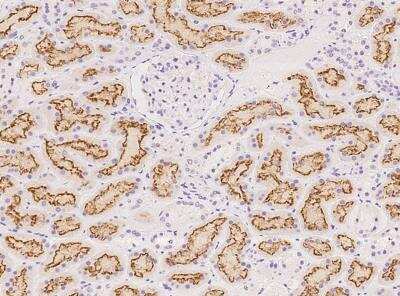 Immunohistochemistry-Paraffin: ZFAND1 Antibody [NBP3-05974]