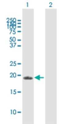 Western Blot: ZFAND1 Antibody [H00079752-B01P]