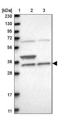 Western Blot: ZFAND1 Antibody [NBP1-82242]