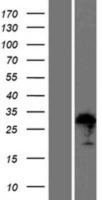 Western Blot: ZFAND1 Overexpression Lysate [NBP2-06301]