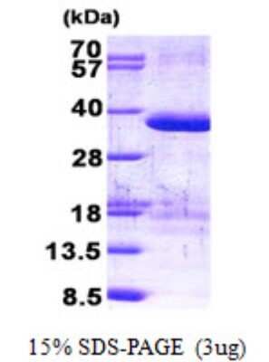 SDS-PAGE: Recombinant Human ZFAND1 His Protein [NBP2-22959]