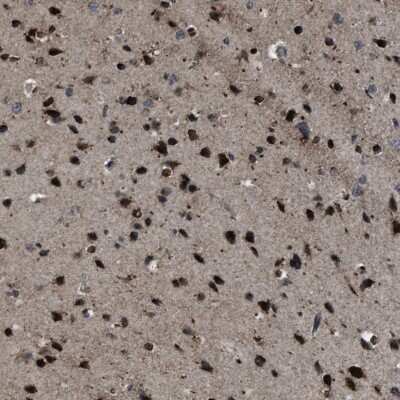 Immunohistochemistry-Paraffin: ZFAND2A Antibody [NBP1-90864]