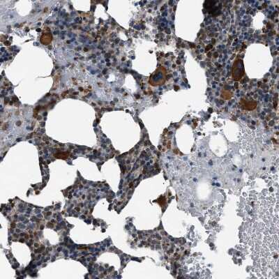 Immunohistochemistry-Paraffin: ZFAND2A Antibody [NBP1-90864]
