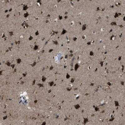 Immunohistochemistry-Paraffin: ZFAND2A Antibody [NBP1-90864]