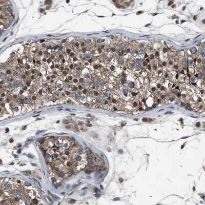 Immunohistochemistry-Paraffin: ZFAND2A Antibody [NBP1-90864]
