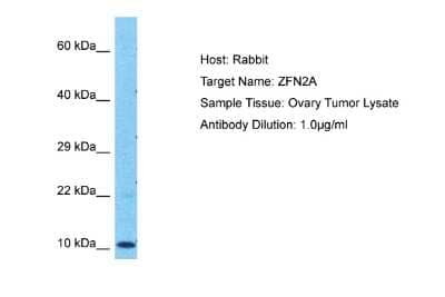 Western Blot: ZFAND2A Antibody [NBP2-83800]