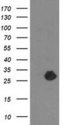 Western Blot: ZFAND2B Antibody (OTI1G10) [NBP2-03636]