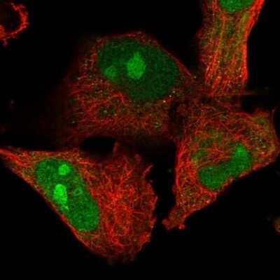 Immunocytochemistry/ Immunofluorescence: ZFAND2B Antibody [NBP1-89174]