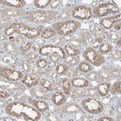 Immunohistochemistry-Paraffin: ZFAND2B Antibody [NBP2-33994]