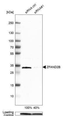 Western Blot: ZFAND2B Antibody [NBP1-89174]