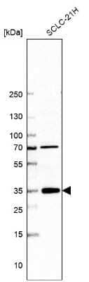 Western Blot: ZFAND2B Antibody [NBP2-33994]