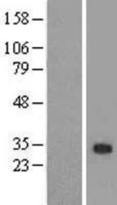 Western Blot: ZFAND2B Overexpression Lysate [NBL1-18012]