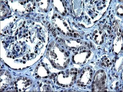 Immunohistochemistry: ZFAND3 Antibody (OTI1H10) [NBP2-46405]