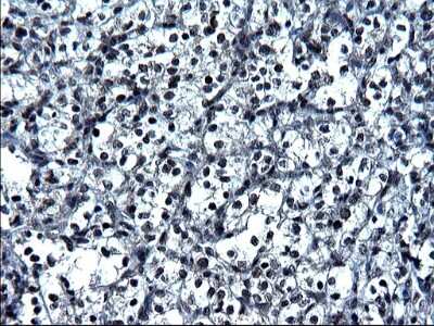 Immunohistochemistry: ZFAND3 Antibody (OTI1H10) [NBP2-46405]