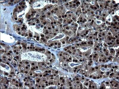 Immunohistochemistry: ZFAND3 Antibody (OTI1H10) [NBP2-46405]