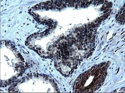 Immunohistochemistry: ZFAND3 Antibody (OTI1H10) [NBP2-46405]