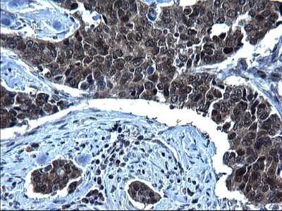 Immunohistochemistry: ZFAND3 Antibody (OTI1H10) [NBP2-46405]