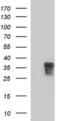 Western Blot: ZFAND3 Antibody (OTI1H10) [NBP2-46405]