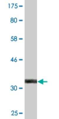 Western Blot: ZFAND3 Antibody (2D2) [H00060685-M03]