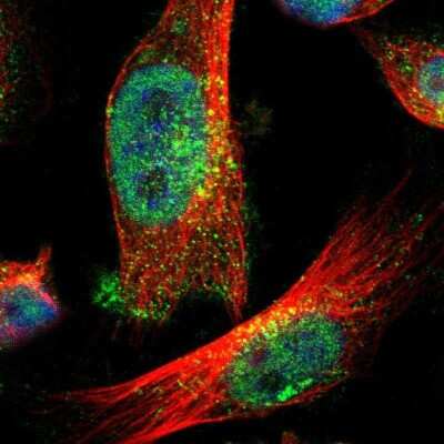 Immunocytochemistry/ Immunofluorescence: ZFAND3 Antibody [NBP1-82262]