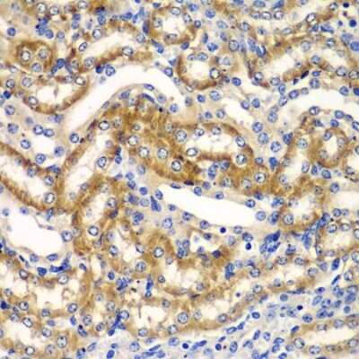 Immunohistochemistry-Paraffin: ZFAND3 Antibody - BSA Free [NBP2-93203]