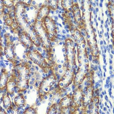 Immunohistochemistry-Paraffin: ZFAND3 Antibody - BSA Free [NBP2-93203]