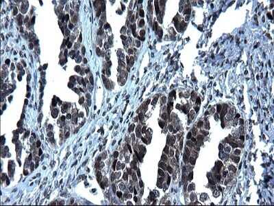 Immunohistochemistry: ZFAND3 Antibody (OTI1H10) - Azide and BSA Free [NBP2-74921]