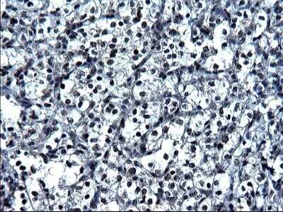 Immunohistochemistry: ZFAND3 Antibody (OTI1H10) - Azide and BSA Free [NBP2-74921]