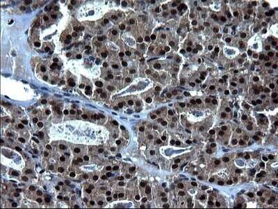 Immunohistochemistry: ZFAND3 Antibody (OTI1H10) - Azide and BSA Free [NBP2-74921]