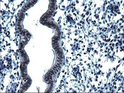 Immunohistochemistry: ZFAND3 Antibody (OTI1H10) - Azide and BSA Free [NBP2-74921]