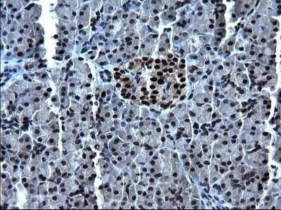 Immunohistochemistry: ZFAND3 Antibody (OTI1H10) - Azide and BSA Free [NBP2-74921]
