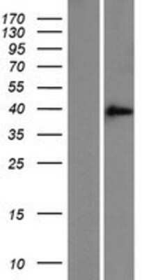 Western Blot: ZFAND3 Overexpression Lysate [NBL1-18013]