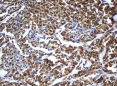 Immunohistochemistry: ZFAND5 Antibody (OTI5H8) [NBP2-45422]