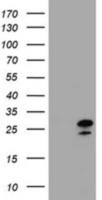 Western Blot: ZFAND5 Antibody (OTI5H8)Azide and BSA Free [NBP2-74922]