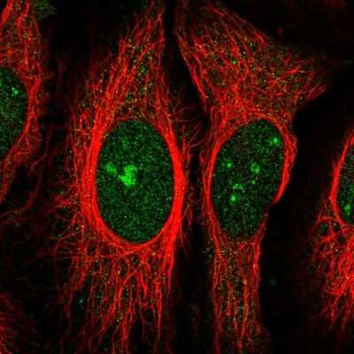 Immunocytochemistry/ Immunofluorescence: ZFP106 Antibody [NBP2-13543]