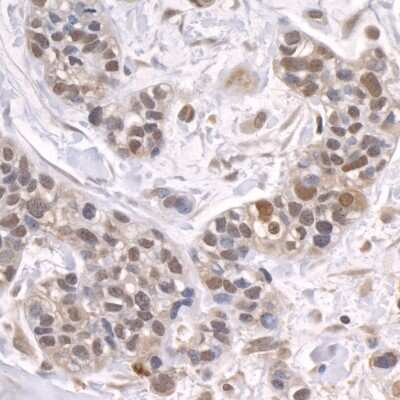 Immunohistochemistry-Paraffin: ZFP106 Antibody [NB100-74654]