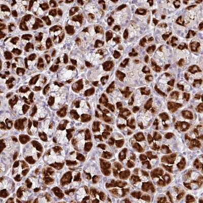 Immunohistochemistry-Paraffin: ZFP106 Antibody [NBP2-13543]