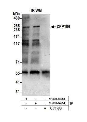 Immunoprecipitation: ZFP106 Antibody [NB100-74653]