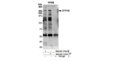 Immunoprecipitation: ZFP106 Antibody [NB100-74654]