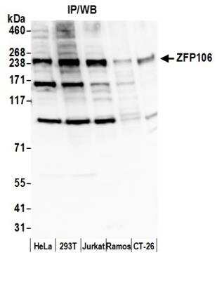 Western Blot: ZFP106 Antibody [NB100-74653]