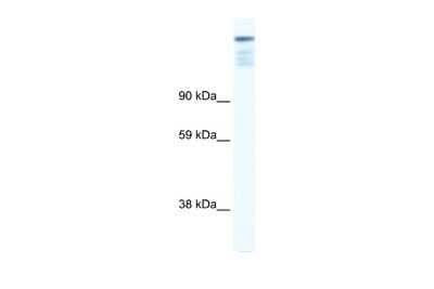 Western Blot: ZFP106 Antibody [NBP2-88616]