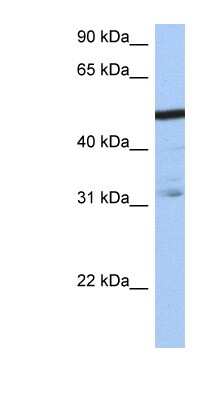 Western Blot: ZFP14 Antibody [NBP1-79388]