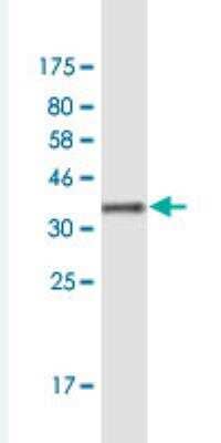 Western Blot: ZBTB14 Antibody (2F1) [H00007541-M01-100ug]