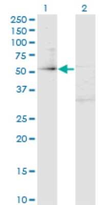 Western Blot: ZBTB14 Antibody (4F7) [H00007541-M02]