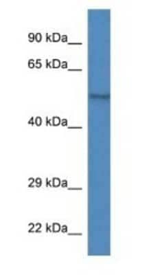 Western Blot: ZBTB14 Antibody [NBP1-74134]