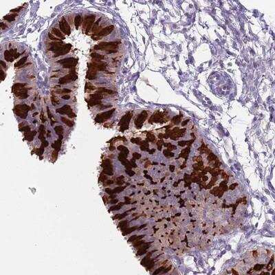 Immunohistochemistry: ZFP2 Antibody [NBP2-13544]